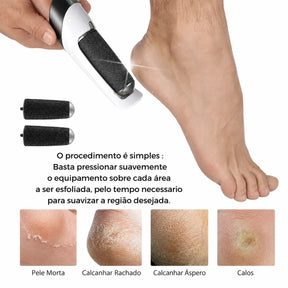 Lixa Eletrica Portátil - Removedor De Calo Para Pés